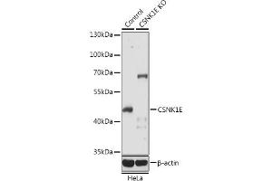 Western blot analysis of extracts from normal (control) and CSNK1E knockout (KO) HeLa cells, using CSNK1E antibody (ABIN6128970, ABIN6139116, ABIN6139117 and ABIN7101448) at 1:1000 dilution. (CK1 epsilon anticorps  (AA 247-416))