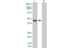 Western Blot analysis of RCC1 expression in transfected 293T cell line by RCC1 monoclonal antibody (M01), clone 2F1.