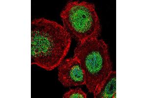 Immunofluorescence (IF) image for anti-Lymphoid Enhancer-Binding Factor 1 (LEF1) antibody (ABIN5016131) (LEF1 anticorps)