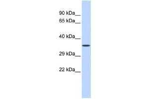 Western Blotting (WB) image for anti-Zinc Finger Protein 124 (ZNF124) antibody (ABIN2458312) (ZNF124 anticorps)