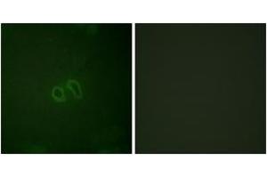 Immunofluorescence analysis of HepG2 cells, using Vinculin (Phospho-Tyr821) Antibody.