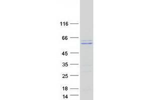 Validation with Western Blot