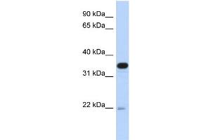 WB Suggested Anti-PITPNB Antibody Titration: 0. (PITPNB anticorps  (Middle Region))