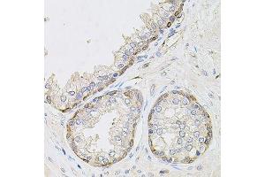 Immunohistochemistry of paraffin-embedded human prostate using CIB1 antibody.