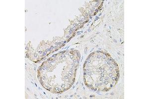 Immunohistochemistry of paraffin-embedded human prostate using CIB1 antibody. (CIB1 anticorps  (AA 1-191))