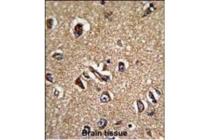 Formalin-fixed and paraffin-embedded human brain tissue reacted with STR Antibody (C-term), which was peroxidase-conjugated to the secondary antibody, followed by DAB staining.