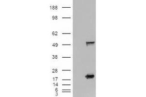 Image no. 3 for anti-Sonic Hedgehog (SHH) (AA 24-197) antibody (ABIN1491248) (Sonic Hedgehog anticorps  (AA 24-197))