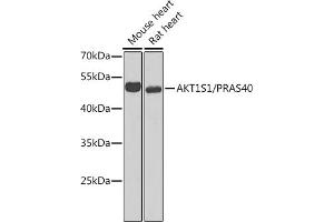 Western blot analysis of extracts of various cell lines, using S1/PR antibody (ABIN6129890, ABIN6136741, ABIN6136742 and ABIN6221835) at 1:1000 dilution.