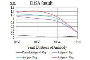 Black line: Control Antigen (100 ng),Purple line: Antigen (10 ng), Blue line: Antigen (50 ng), Red line:Antigen (100 ng)