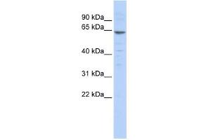 WB Suggested Anti-ZNF192 Antibody Titration:  0. (ZNF192 anticorps  (N-Term))