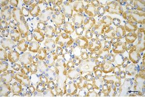 Immunohistochemistry was performed on paraffin-embedded mouse kidney using ACAT1 antibody (ABIN7797438), 1:200).