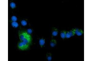 Image no. 5 for anti-Sequestosome 1 (SQSTM1) antibody (ABIN1499991) (SQSTM1 anticorps)