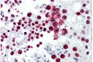 Human Testis: Formalin-Fixed, Paraffin-Embedded (FFPE) (CDKL1 anticorps  (AA 259-358))