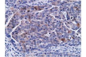 Immunohistochemical staining of paraffin-embedded Human Kidney tissue using anti-CD80 mouse monoclonal antibody. (CD80 anticorps)