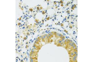Immunohistochemistry of paraffin-embedded mouse lung using SLC37A4 antibody. (SLC37A4 anticorps)