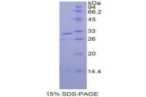 SDS-PAGE (SDS) image for V-Rel Reticuloendotheliosis Viral Oncogene Homolog B (RELB) (AA 248-492) protein (His tag) (ABIN1877490)