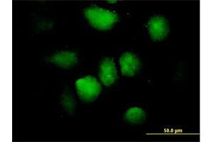 Immunofluorescence of purified MaxPab antibody to ZNF74 on HeLa cell. (ZNF74 anticorps  (AA 1-644))