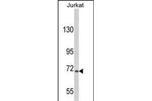 Western blot analysis of hUSP19- (ABIN388908 and ABIN2839191) in Jurkat cell line lysates (35 μg/lane). (USP19 anticorps  (C-Term))