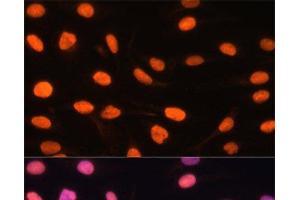 Immunofluorescence analysis of U-2 OS cells using ZBED1 Polyclonal Antibody at dilution of 1:100.