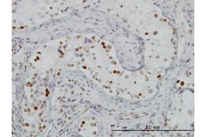 Immunoperoxidase of monoclonal antibody to BRD3 on formalin-fixed paraffin-embedded human testis. (BRD3 anticorps  (AA 418-556))