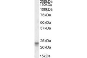 Image no. 2 for anti-Tetraspanin 8 (TSPAN8) (AA 178-192) antibody (ABIN462699) (Tspan-8 anticorps  (AA 178-192))
