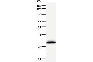 Western Blotting (WB) image for anti-Deoxycytidine Kinase (DCK) antibody (ABIN931037) (DCK anticorps)