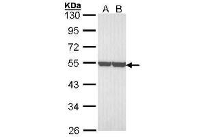 WB Image Sample (30 ug of whole cell lysate) A: A431 , B: H1299 10% SDS PAGE antibody diluted at 1:3000 (ENO1 anticorps)