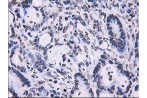 Image no. 7 for anti-Replication Protein A2, 32kDa (RPA2) antibody (ABIN1500735) (RPA2 anticorps)