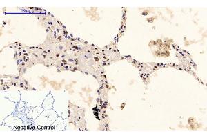 Immunohistochemical analysis of paraffin-embedded human lung tissue.