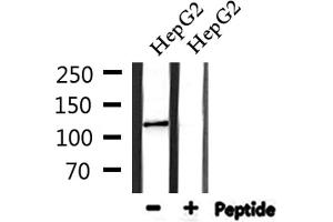 Western blot analysis of extracts from HepG2, using Collagen I α2 Antibody.