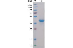 Human BCMA, hFc-His Tag on SDS-PAGE under reducing condition.