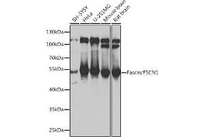 Western blot analysis of extracts of various cell lines, using Fascin/Fascin/FSCN1 antibody (ABIN6131667, ABIN6140779, ABIN6140780 and ABIN6217317) at 1:1000 dilution. (Fascin anticorps  (AA 260-380))