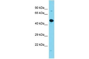 Host: Rabbit Target Name: GPATCH2L Sample Type: Fetal Brain lysates Antibody Dilution: 1. (GPATCH2L anticorps  (Middle Region))