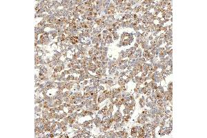 IHC analysis of SLC20A1 using anti-SLC20A1 antibody (ABIN7602463).