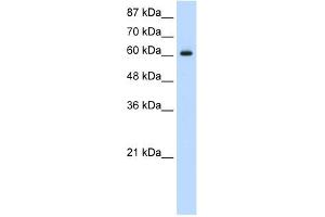 Western Blot showing HIF3A antibody used at a concentration of 1-2 ug/ml to detect its target protein. (HIF3A anticorps  (C-Term))