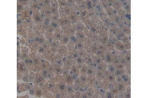 Used in DAB staining on fromalin fixed paraffin- embedded liver tissue