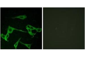 Immunofluorescence analysis of LOVO cells, using HRH2 Antibody. (HRH2 anticorps  (AA 131-180))