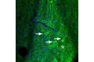 Expression of Adenosine A2A Receptor in mouse diagonal band - Immunohistochemical staining of mouse diagonal band using Anti-Adenosine A2A Receptor Antibody (ABIN7042883, ABIN7043888 and ABIN7043889).
