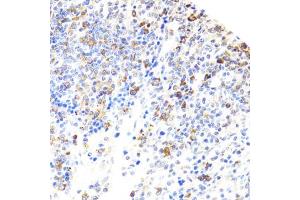 Immunohistochemistry of paraffin-embedded rat spleen using BTK antibody (ABIN3022170, ABIN3022171, ABIN3022172 and ABIN6218643) at dilution of 1:100 (40x lens).