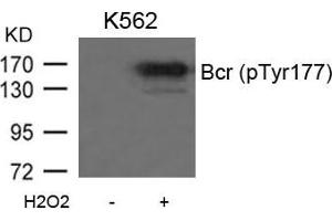 Western blot analysis of extracts from K562 cells untreated or treated with H2O2 using Bcr(Phospho-Tyr177) Antibody.