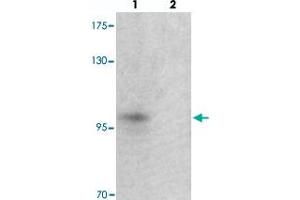 Western blot analysis of TSHZ2 in A-20 cell lysate with TSHZ2 polyclonal antibody  at 1 ug/mL in (lane 1) the absence and (lane 2) the presence of blocking peptide.