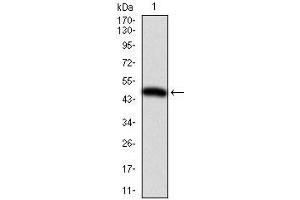 Western blot analysis using ITGB1 mAb against human ITGB1 (AA: 50-270) recombinant protein. (ITGB1 anticorps)