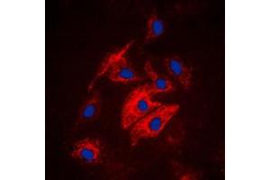 anti-Microtubule Associated serine/threonine Kinase 4 (MAST4) (N-Term) antibody