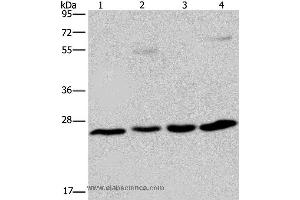 Western blot analysis of A549 cell and human hepatocellular carcinoma, mouse liver tissue and HT-29 cell, using ETHE1 Polyclonal Antibody at dilution of 1:400 (ETHE1 anticorps)