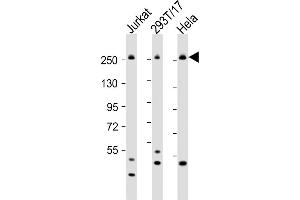 All lanes : Anti-CAD Antibody (Center) at 1:2000 dilution Lane 1: Jurkat whole cell lysate Lane 2: 293T/17 whole cell lysate Lane 3: Hela whole cell lysate Lysates/proteins at 20 μg per lane.