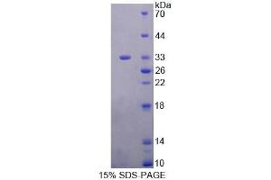 SDS-PAGE analysis of Human EEF1b2 Protein. (EEF1B2 Protéine)
