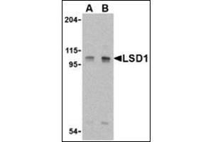 Western blot analysis of LSD1 in P815 cell lysate with this product at (A) 1 and (B) 2 μg/ml.