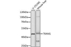 Western blot analysis of extracts of various cell lines, using TR antibody (ABIN7270934) at 1:1000 dilution. (TRAM1 anticorps  (AA 305-374))