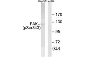 Western blot analysis of extracts from HepG2 cells treated with PMA 125ng/ml 20', using FAK (Phospho-Ser843) Antibody. (FAK anticorps  (pSer843))