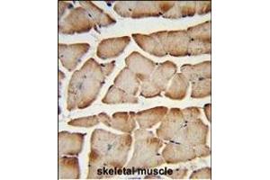 Formalin-fixed and paraffin-embedded human skeletal muscle reacted with T150A Antibody (Center), which was peroxidase-conjugated to the secondary antibody, followed by DAB staining. (TMEM150A anticorps  (AA 81-108))